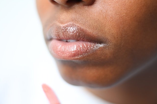 Are Lip Fillers on the Verge of a Transformation? Here’s What You Should Know
