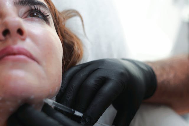 What to Know About Dermal Fillers Before and After Treatment