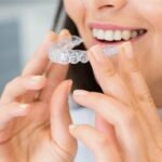How Straightening Your Teeth Can Transform Your Smile