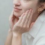 Preparing for Microneedling with Sensitive Skin: A Guide