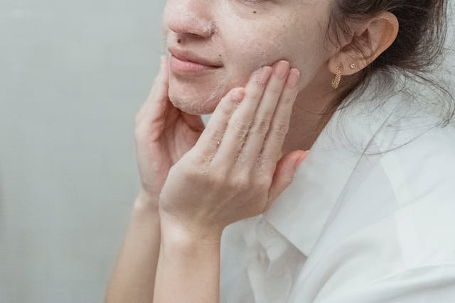 Preparing for Microneedling with Sensitive Skin: A Guide