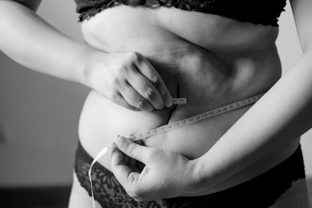 Embrace Your Body: The Benefits of Frozen Belly Fat for Radiance